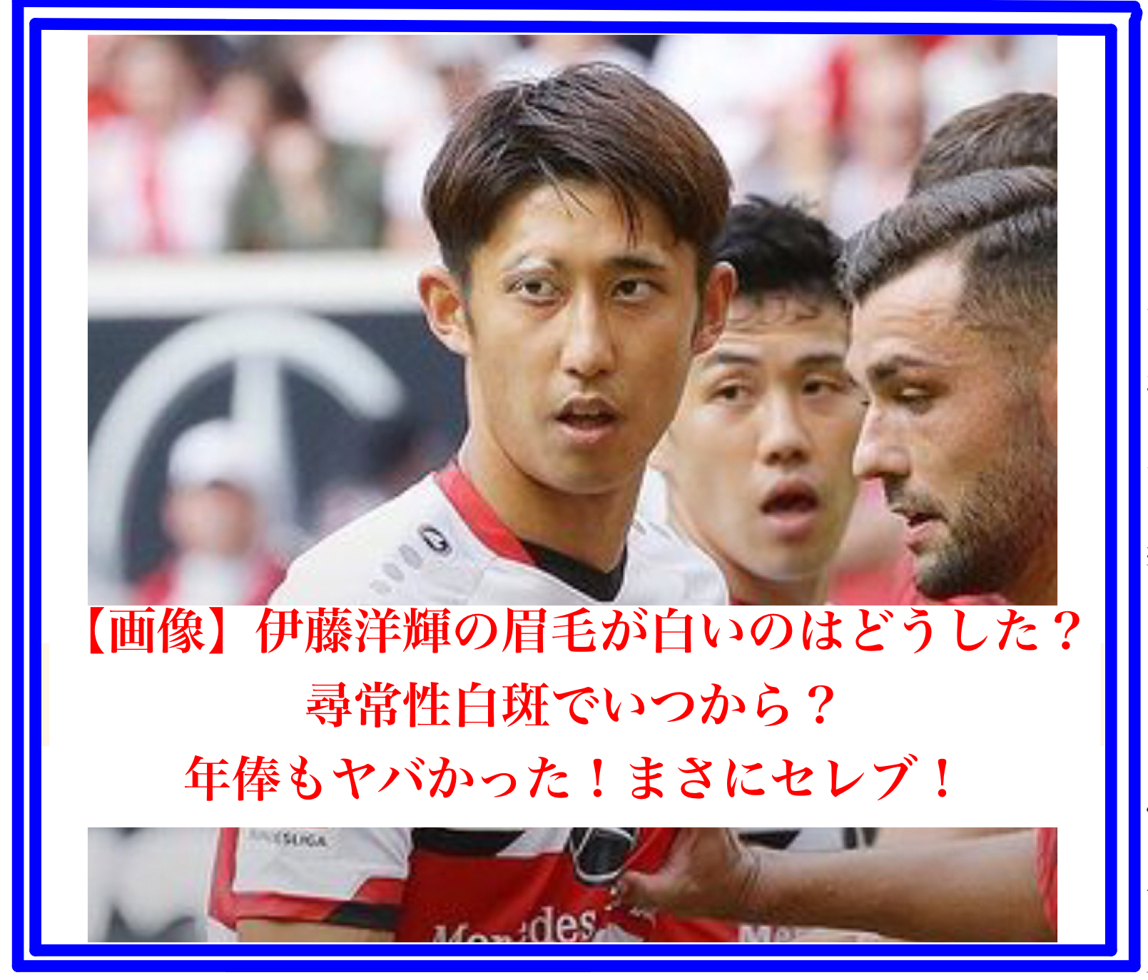 【画像】伊藤洋輝の眉毛が白いのはどうした？ 尋常性白斑でいつから？　 年俸もヤバかった！まさにセレブ！