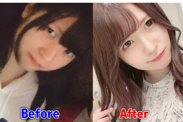 のりぽんチャンネルぽんちゃんは整形してる！
